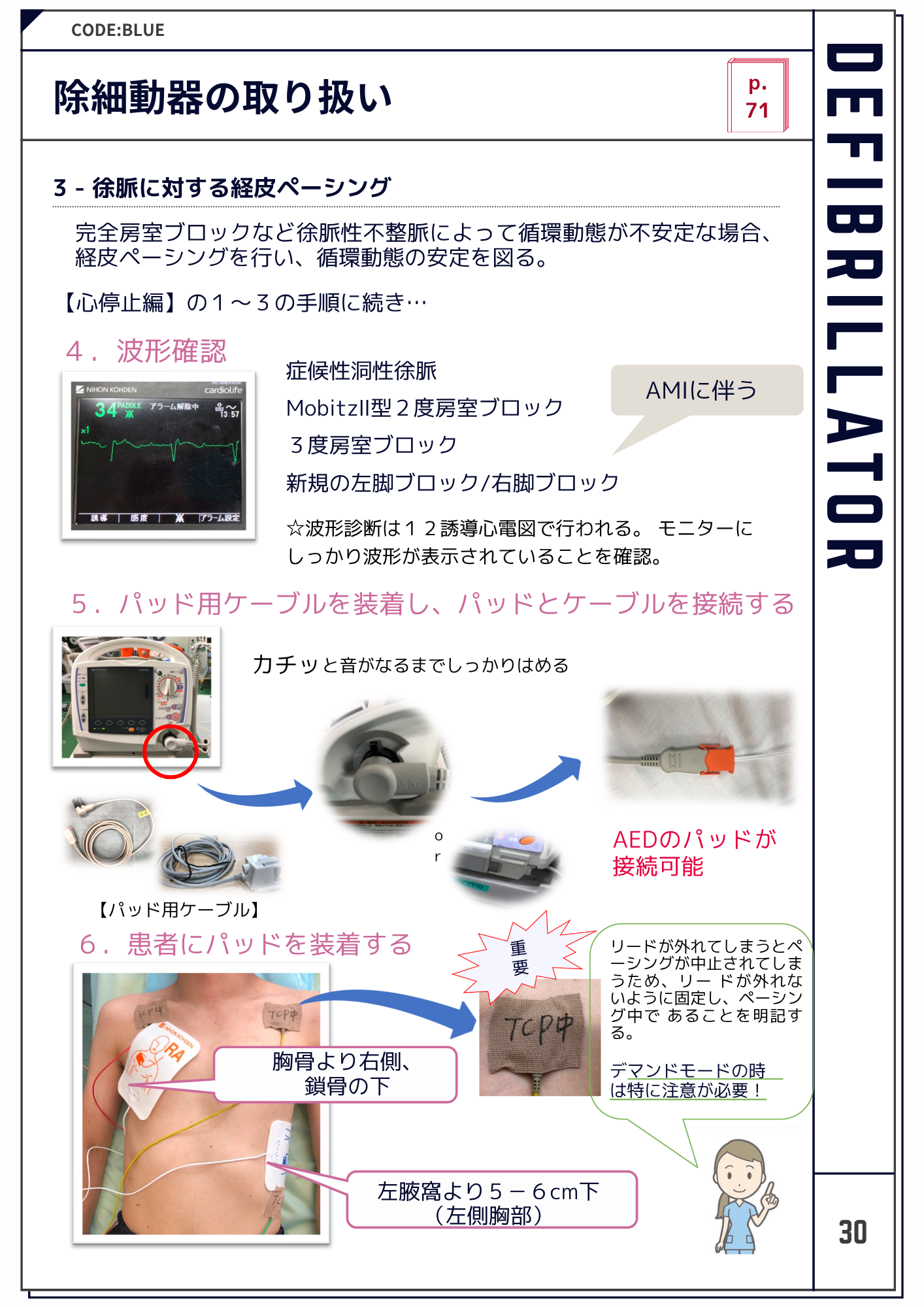 ACLS補足教材画像2
